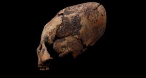 East Asians may have been reshaping their skulls 12,000 years ago  Science News