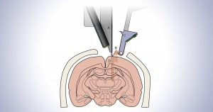 Elon Musk's Neuralink to detail progress in computer-brain interface - CNET