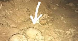 Elongated skull found and immediately stolen in Bulgaria : conspiracy